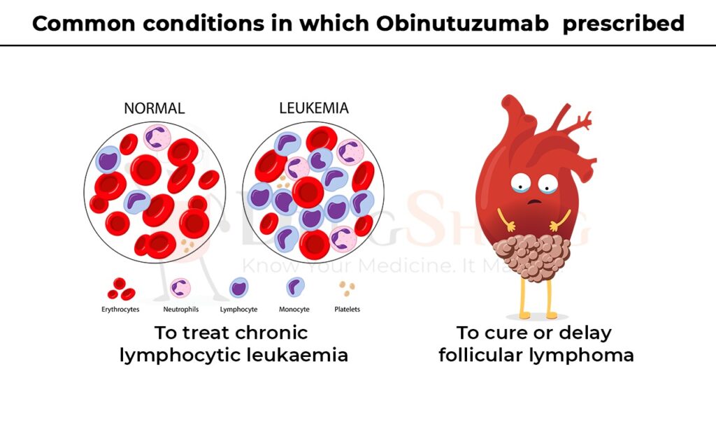 common conditiion in which obinutuzumab prescribed