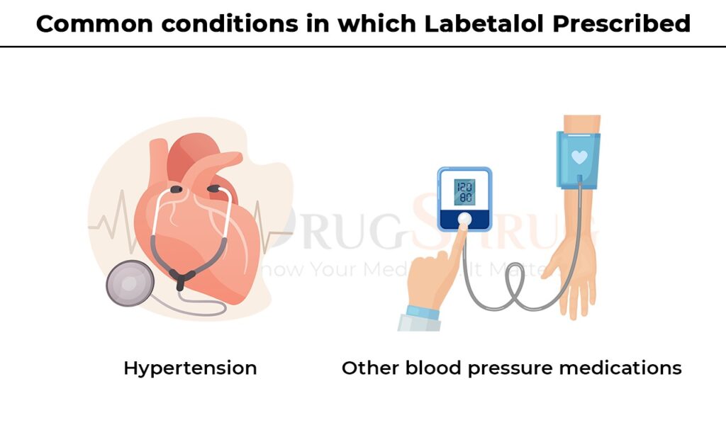 common condition in which labetalol prescribed