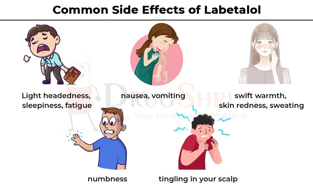 common side effects of labetalol