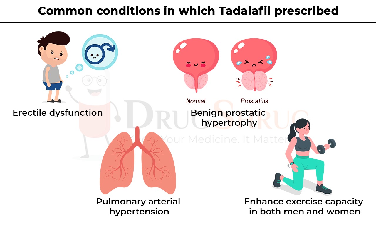Common Conditions for Tadalafil