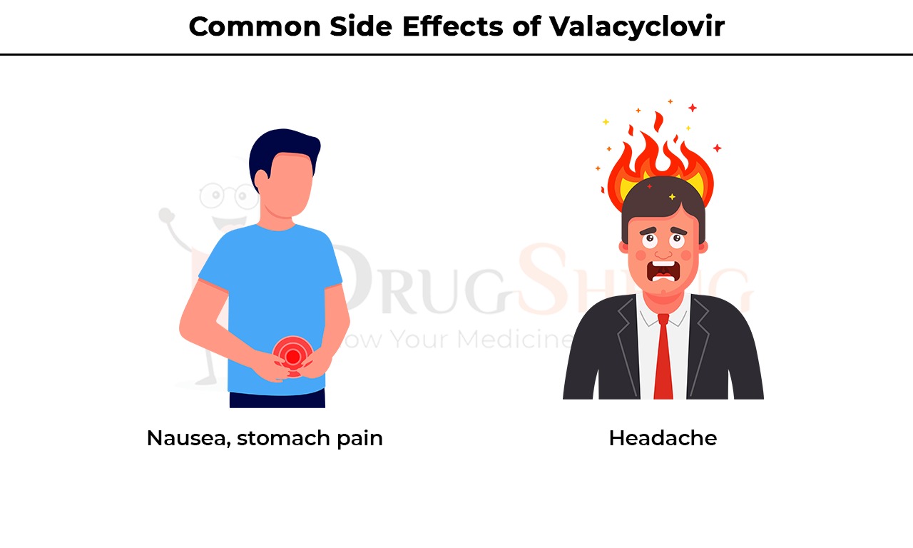 Common Side Effects of Valacyclovir