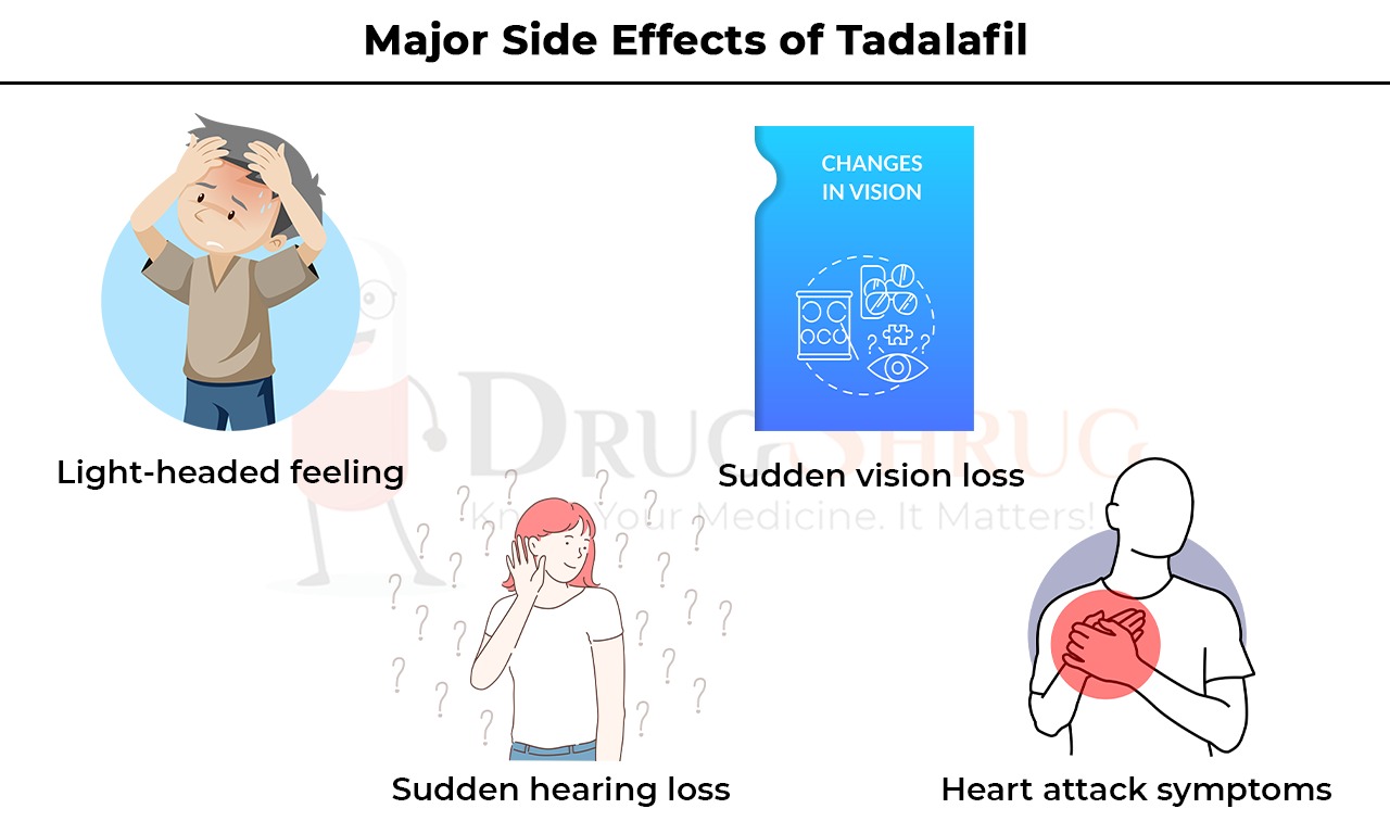 Major Side Effects of Tadalafil